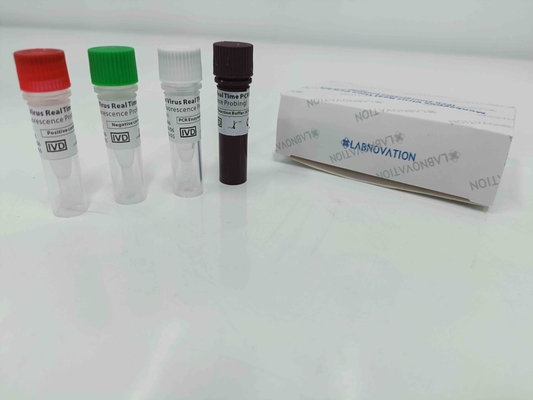 ชุดทดสอบ Monkeypox PCR แบบเรียลไทม์พร้อมการควบคุมเชิงบวก / เชิงลบ