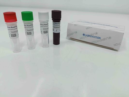 คุณภาพ  Real Time Monkeypox PCR Test Kit With Positive / Negative Control โรงงาน